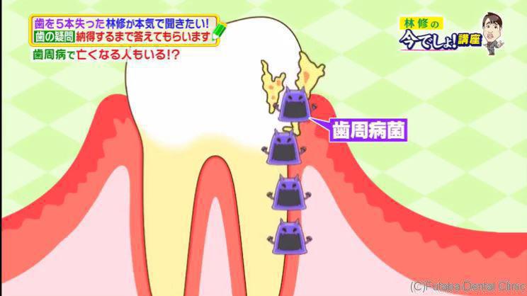 林修の今でしょ!講座 - 16.02.09 - 日本综艺 - MioMio弹幕网 - ( ^ω^)你是我的Master吗 - miomio.tv.mp4_002030040